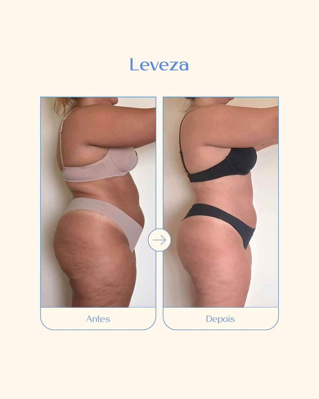 Leveza - Controlo do apetite